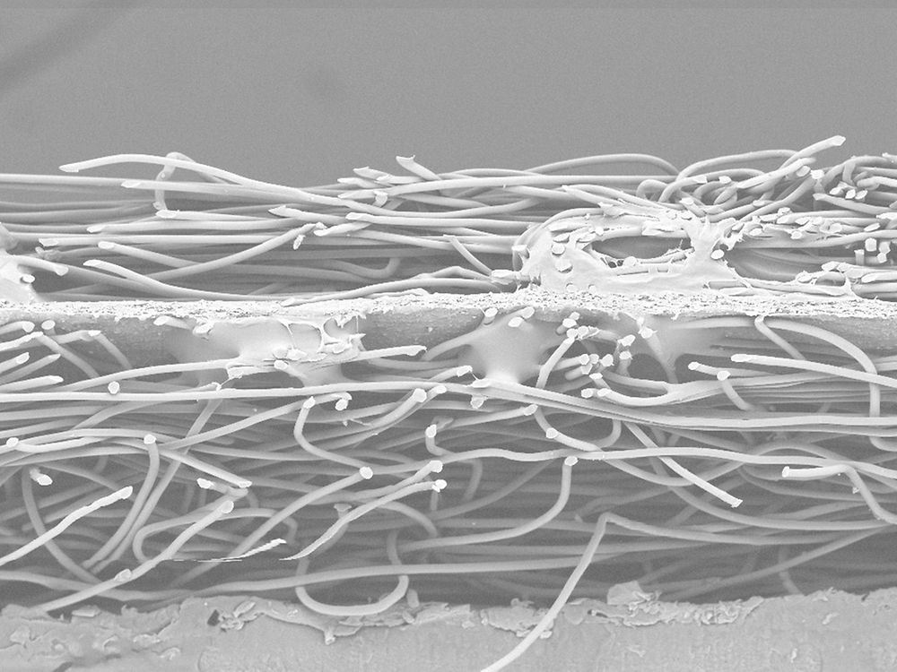 White fibers on grey background done by a raster electron microscope represent our surface analysis techniques.